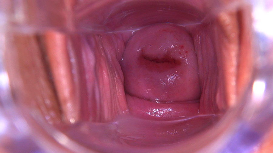 859 Tracy Gold: In Speculum Magnificum
